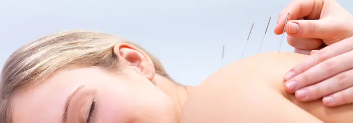 page-acupuncture1 acupuncture